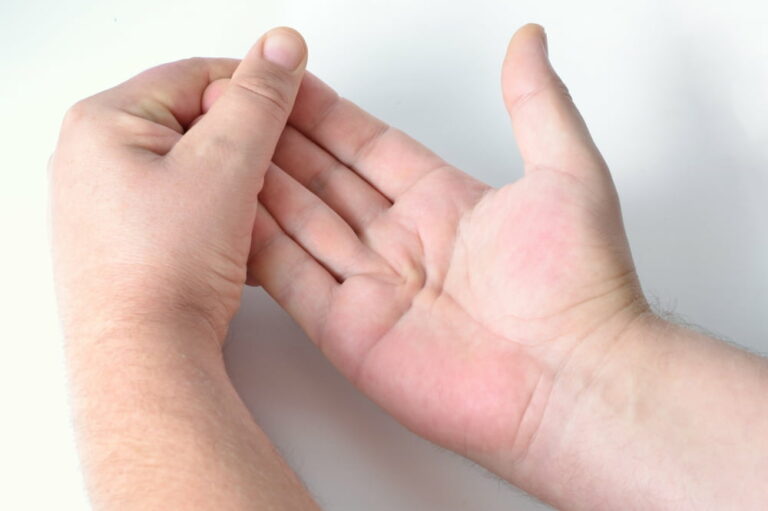 4 warning signs of Dupuytren&#8217;s contracture